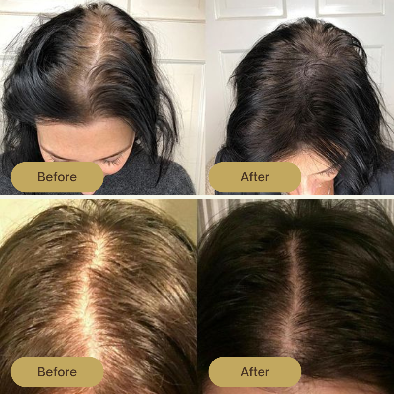 Grows Vegan Hair Growth Oil