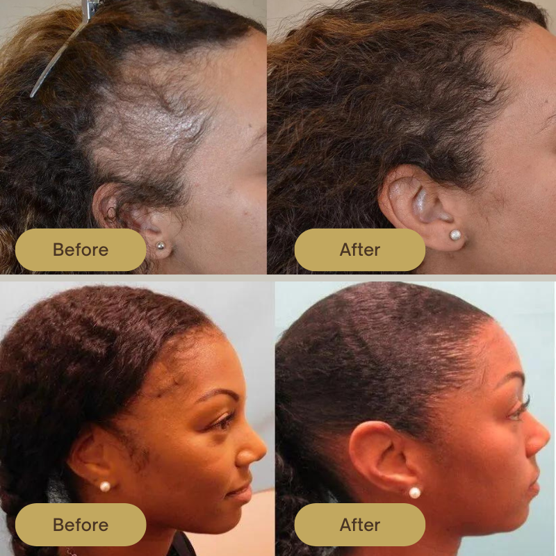 Grows Vegan Hair Growth Oil