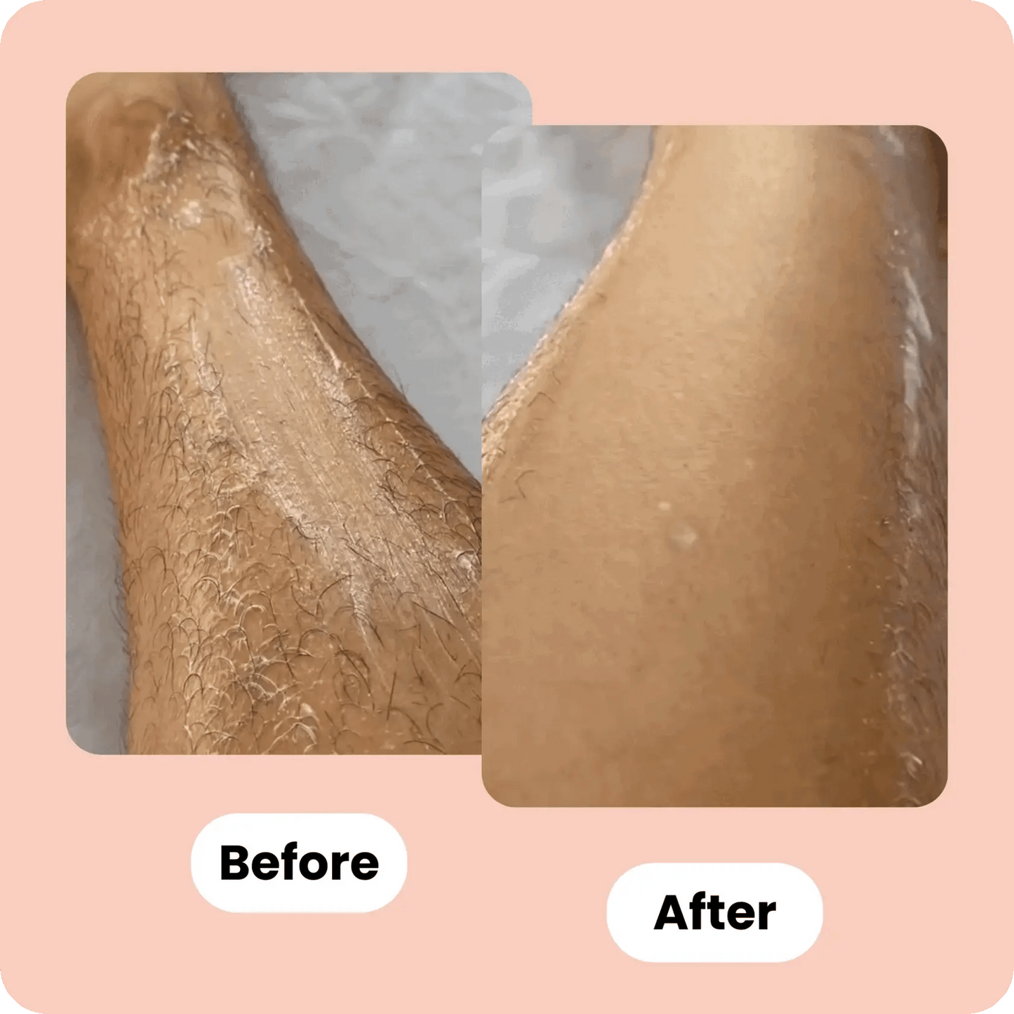 SilkLady™ Perfect Glide Safety Razor